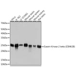 Western Blot - Anti-Casein Kinase 2 beta Antibody [ARC1069] (A309247) - Antibodies.com
