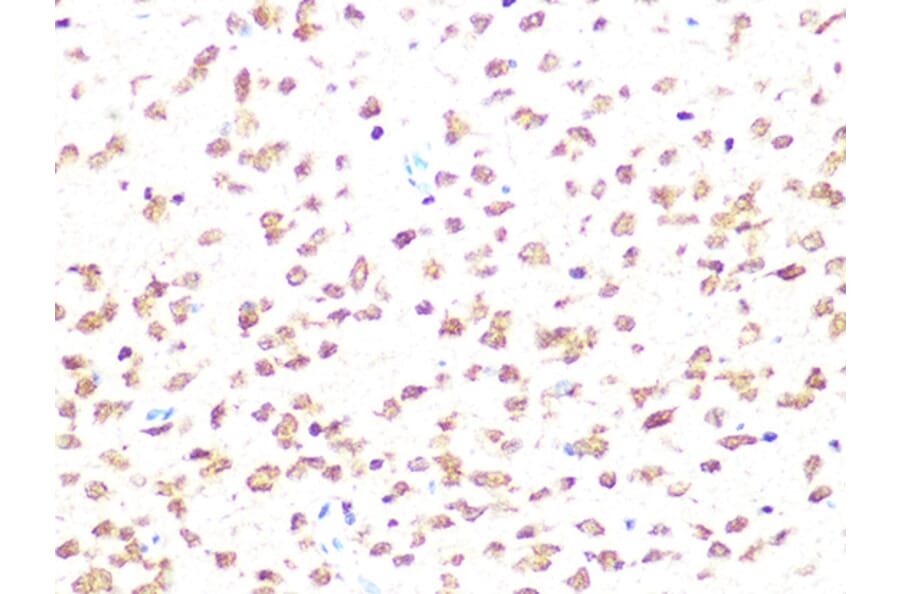 Immunohistochemistry - Anti-Casein Kinase 2 beta Antibody [ARC1069] (A309247) - Antibodies.com