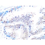 Immunohistochemistry - Anti-Casein Kinase 2 beta Antibody [ARC1069] (A309247) - Antibodies.com