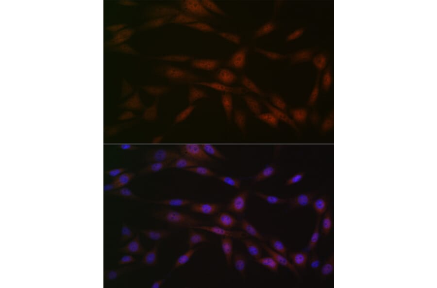 Immunofluorescence - Anti-Casein Kinase 2 beta Antibody [ARC1069] (A309247) - Antibodies.com