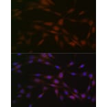 Immunofluorescence - Anti-Casein Kinase 2 beta Antibody [ARC1069] (A309247) - Antibodies.com