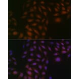 Immunofluorescence - Anti-Casein Kinase 2 beta Antibody [ARC1069] (A309247) - Antibodies.com