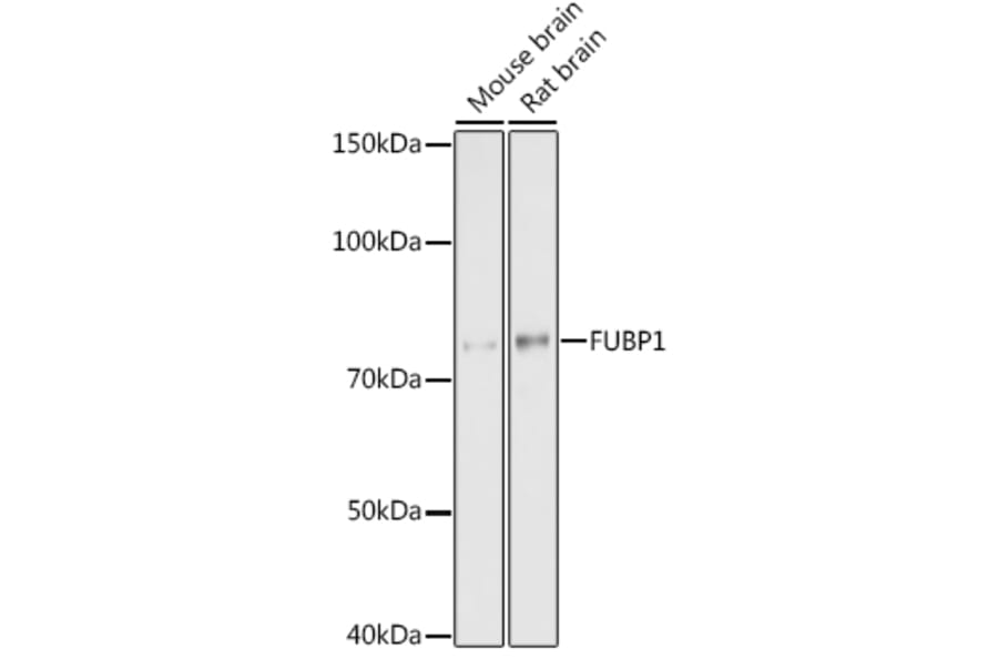 Western Blot - Anti-FUBP1/FBP Antibody [ARC1403] (A309248) - Antibodies.com
