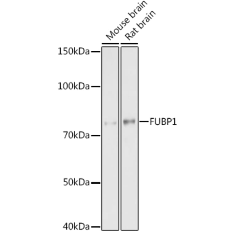 Western Blot - Anti-FUBP1/FBP Antibody [ARC1403] (A309248) - Antibodies.com