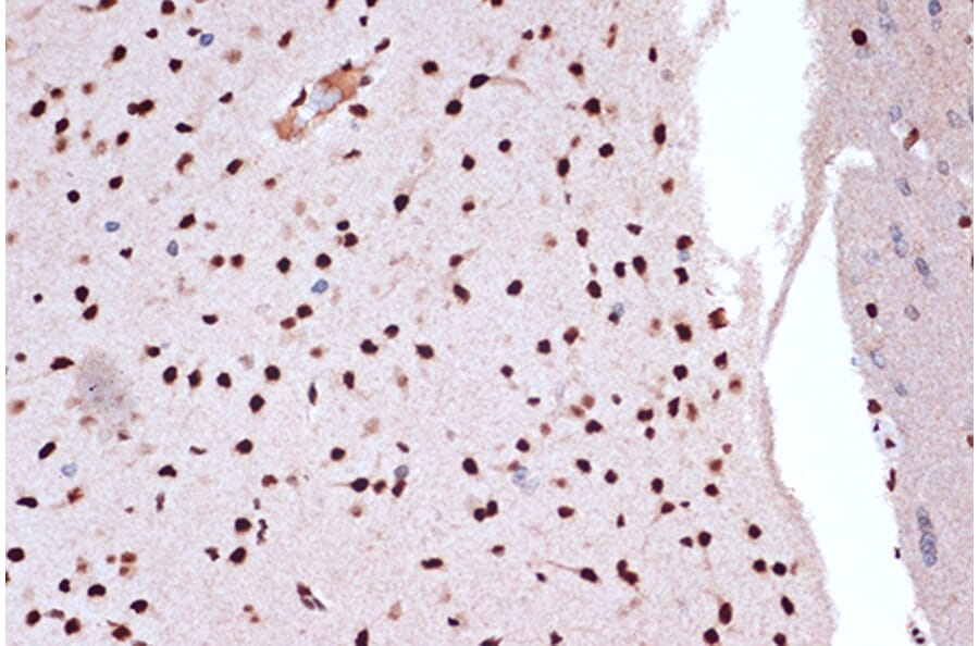 Immunohistochemistry - Anti-FUBP1/FBP Antibody [ARC1403] (A309248) - Antibodies.com
