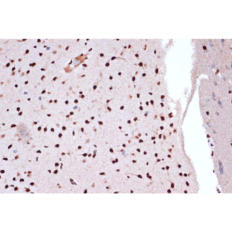Immunohistochemistry - Anti-FUBP1/FBP Antibody [ARC1403] (A309248) - Antibodies.com