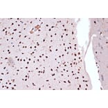 Immunohistochemistry - Anti-FUBP1/FBP Antibody [ARC1403] (A309248) - Antibodies.com