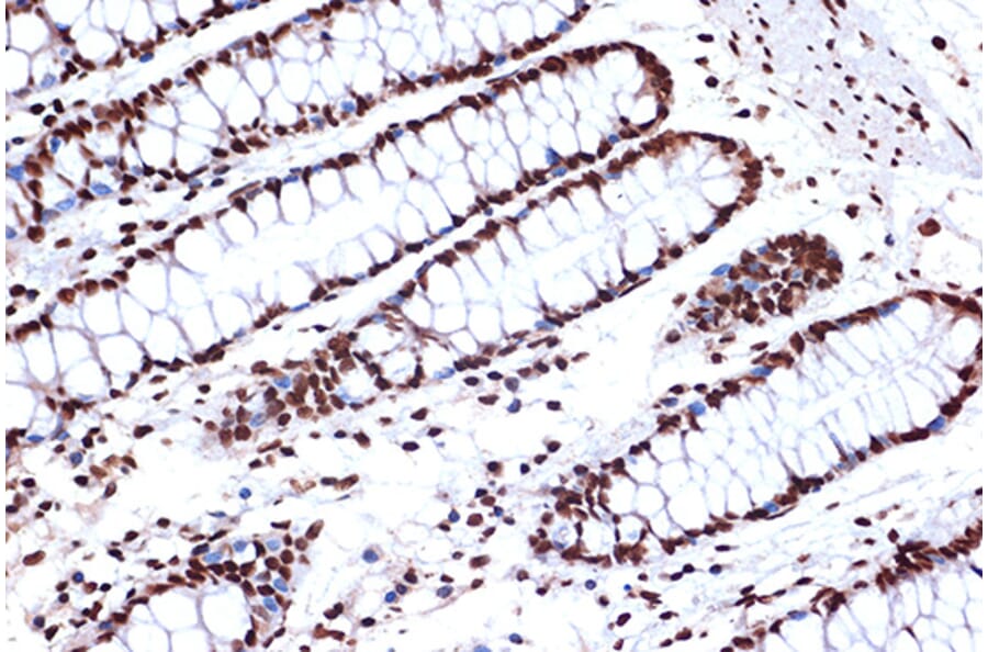 Immunohistochemistry - Anti-FUBP1/FBP Antibody [ARC1403] (A309248) - Antibodies.com