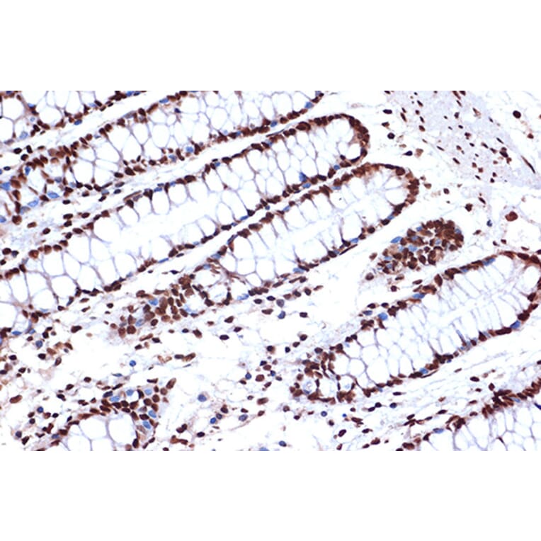 Immunohistochemistry - Anti-FUBP1/FBP Antibody [ARC1403] (A309248) - Antibodies.com