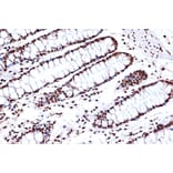 Immunohistochemistry - Anti-FUBP1/FBP Antibody [ARC1403] (A309248) - Antibodies.com