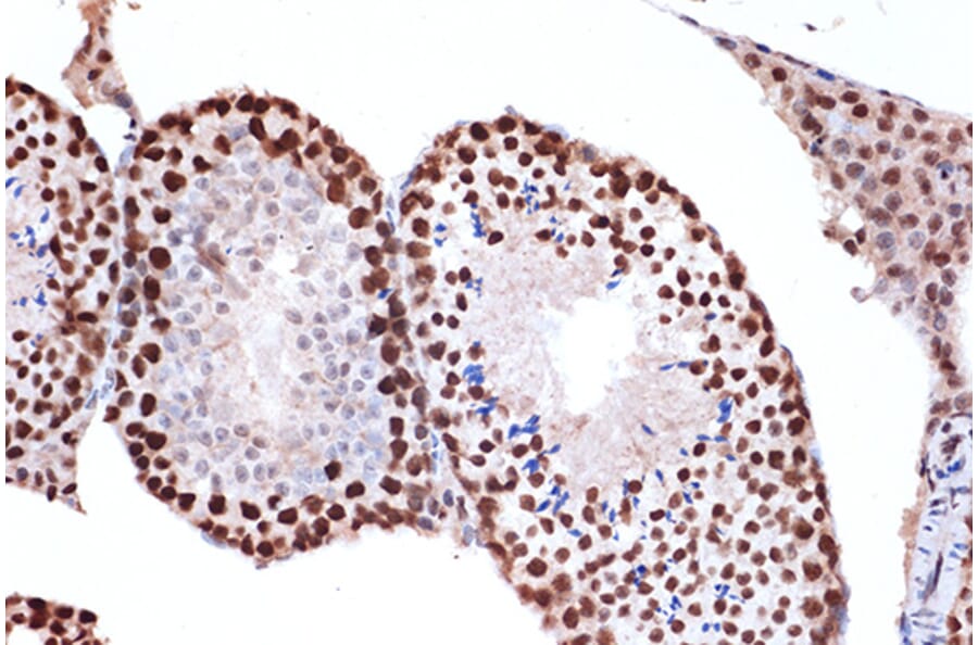 Immunohistochemistry - Anti-FUBP1/FBP Antibody [ARC1403] (A309248) - Antibodies.com