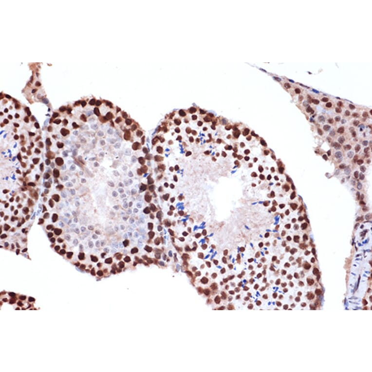 Immunohistochemistry - Anti-FUBP1/FBP Antibody [ARC1403] (A309248) - Antibodies.com