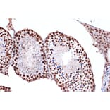 Immunohistochemistry - Anti-FUBP1/FBP Antibody [ARC1403] (A309248) - Antibodies.com