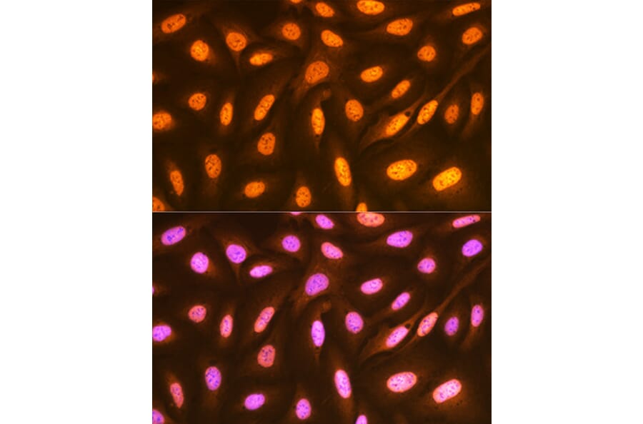 Immunofluorescence - Anti-FUBP1/FBP Antibody [ARC1403] (A309248) - Antibodies.com