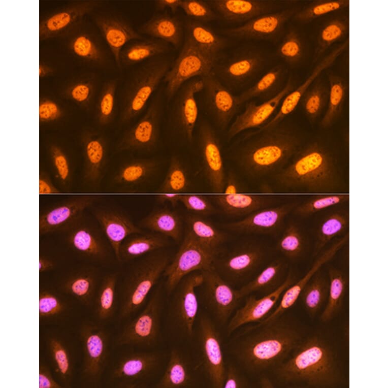 Immunofluorescence - Anti-FUBP1/FBP Antibody [ARC1403] (A309248) - Antibodies.com