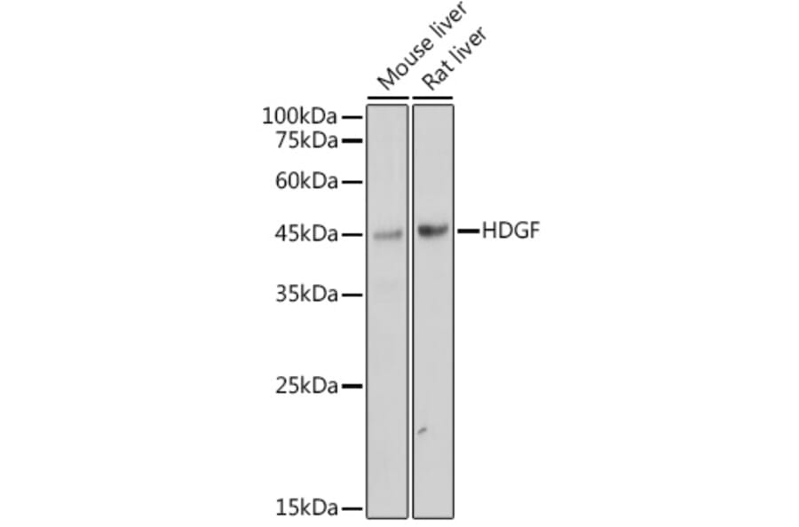 Western Blot - Anti-HDGF Antibody [ARC2522] (A309249) - Antibodies.com