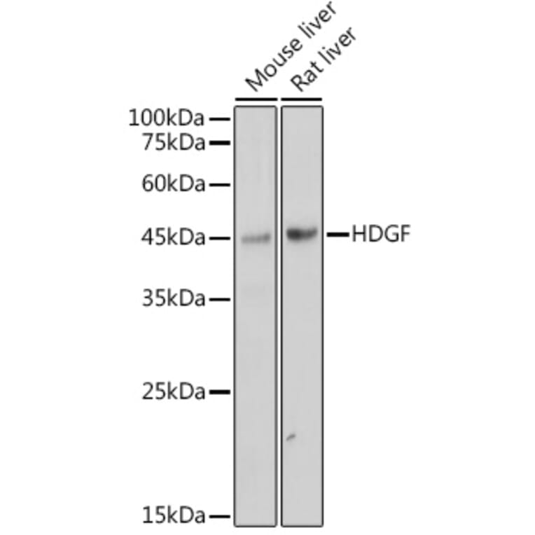 Western Blot - Anti-HDGF Antibody [ARC2522] (A309249) - Antibodies.com