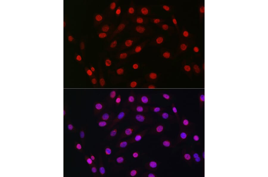 Immunofluorescence - Anti-HDGF Antibody [ARC2522] (A309249) - Antibodies.com