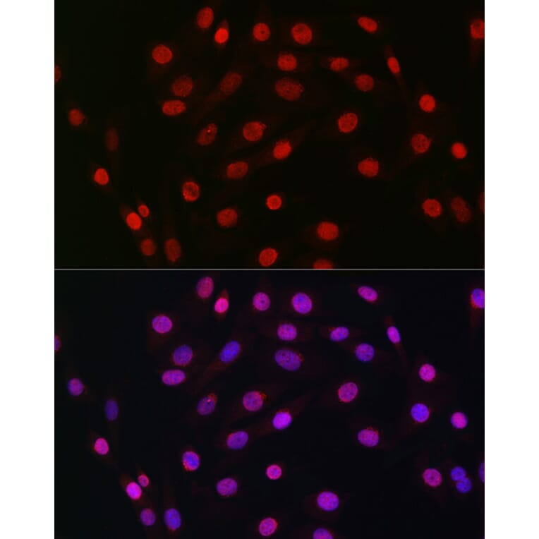 Immunofluorescence - Anti-HDGF Antibody [ARC2522] (A309249) - Antibodies.com