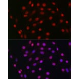 Immunofluorescence - Anti-HDGF Antibody [ARC2522] (A309249) - Antibodies.com