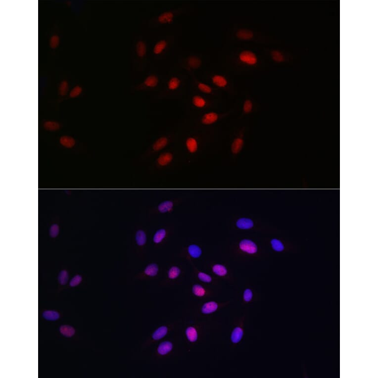 Immunofluorescence - Anti-HDGF Antibody [ARC2522] (A309249) - Antibodies.com