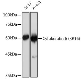 Western Blot - Anti-Cytokeratin 6c Antibody [ARC2352] (A309251) - Antibodies.com