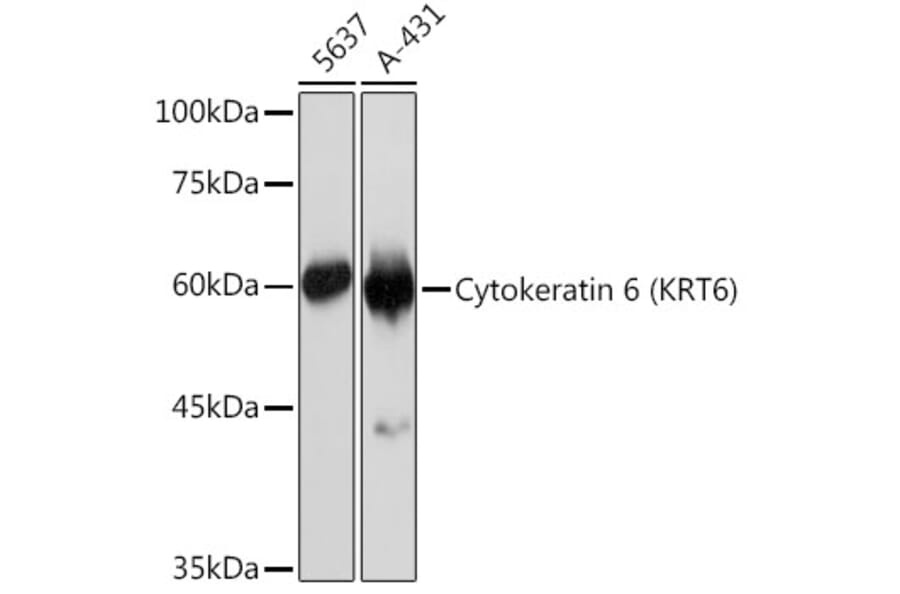 Western Blot - Anti-Cytokeratin 6c Antibody [ARC2352] (A309251) - Antibodies.com