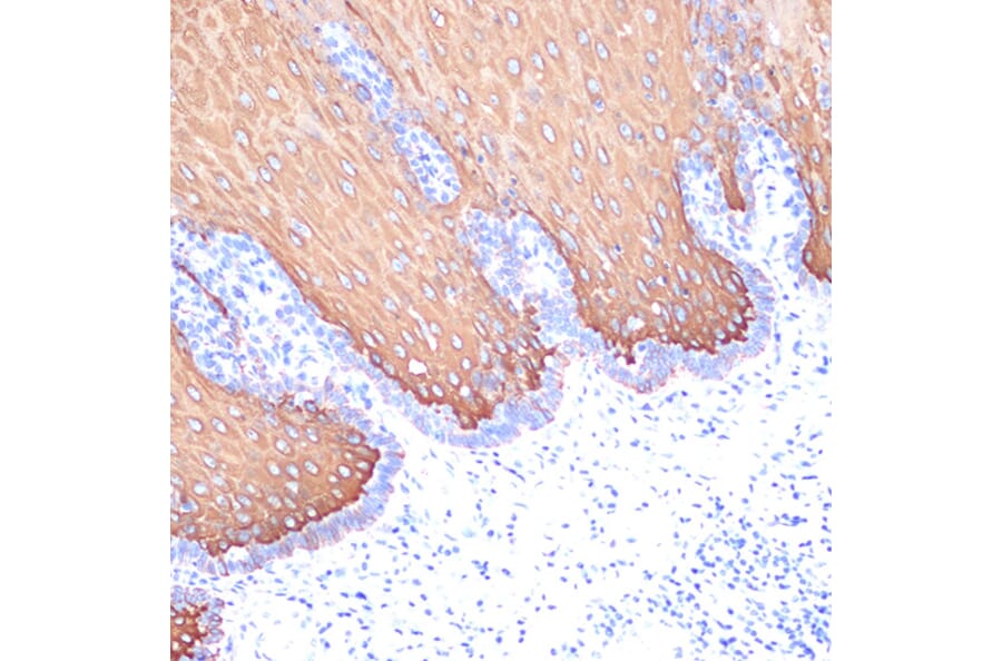 Immunohistochemistry - Anti-Cytokeratin 6c Antibody [ARC2352] (A309251) - Antibodies.com