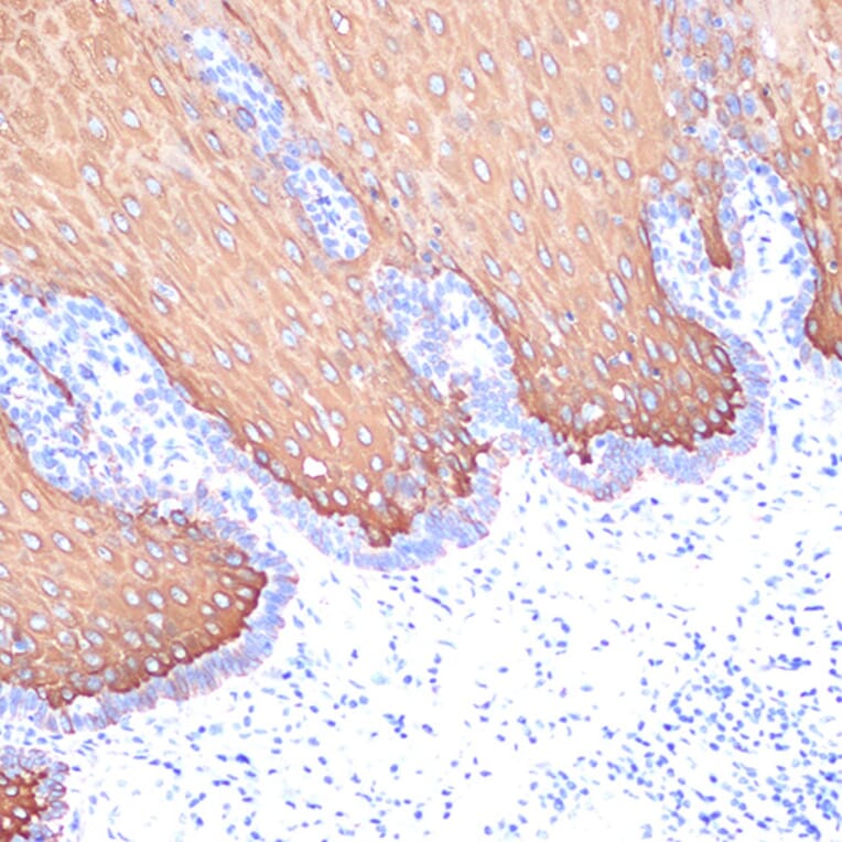 Immunohistochemistry - Anti-Cytokeratin 6c Antibody [ARC2352] (A309251) - Antibodies.com