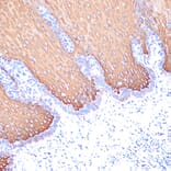 Immunohistochemistry - Anti-Cytokeratin 6c Antibody [ARC2352] (A309251) - Antibodies.com