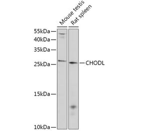Western Blot - Anti-CHODL Antibody (A309252) - Antibodies.com