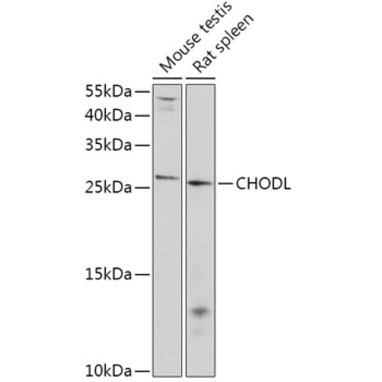 Western Blot - Anti-CHODL Antibody (A309252) - Antibodies.com