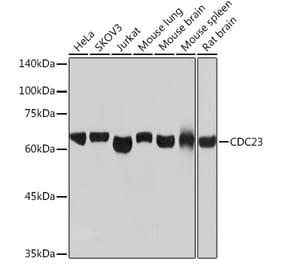 Western Blot - Anti-Cdc23 Antibody [ARC2133] (A309255) - Antibodies.com