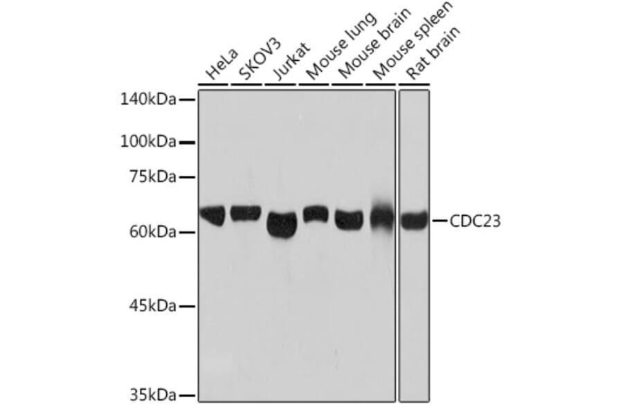 Western Blot - Anti-Cdc23 Antibody [ARC2133] (A309255) - Antibodies.com