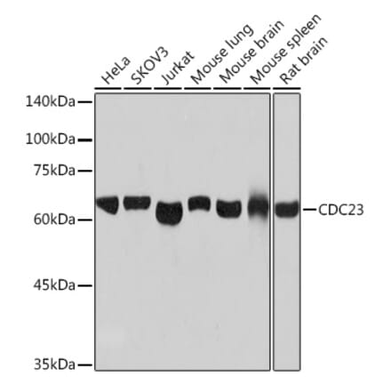 Western Blot - Anti-Cdc23 Antibody [ARC2133] (A309255) - Antibodies.com