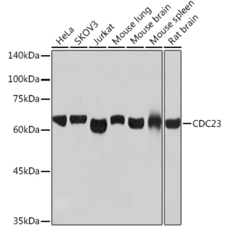 Western Blot - Anti-Cdc23 Antibody [ARC2133] (A309255) - Antibodies.com