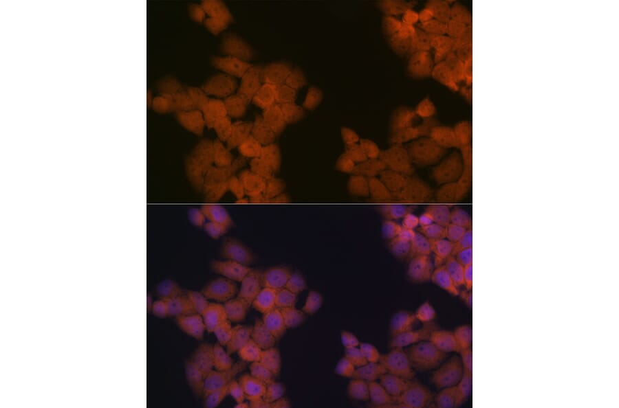 Immunofluorescence - Anti-Cdc23 Antibody [ARC2133] (A309255) - Antibodies.com