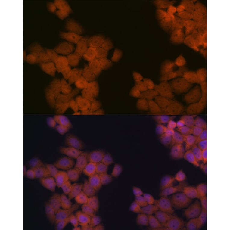 Immunofluorescence - Anti-Cdc23 Antibody [ARC2133] (A309255) - Antibodies.com