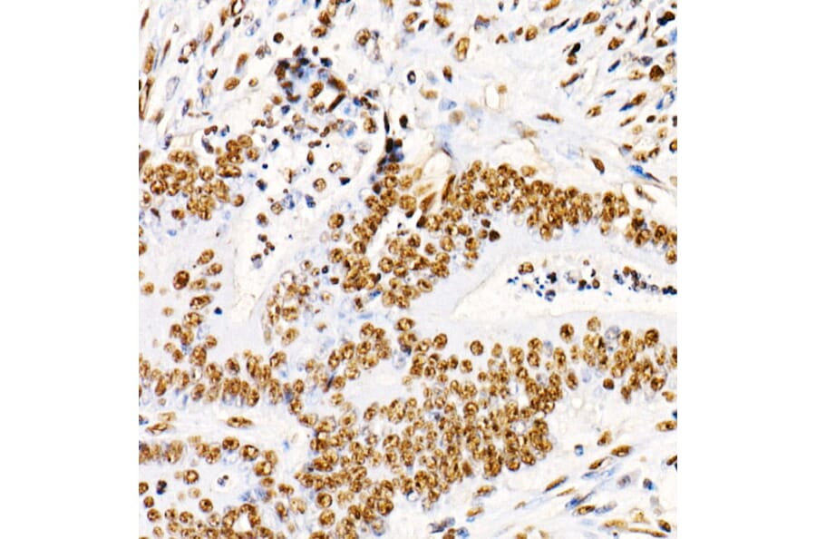 Immunohistochemistry - Anti-PTEN (phospho Ser380 + Thr382 + Thr383) Antibody (A309256) - Antibodies.com