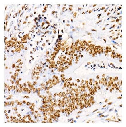 Immunohistochemistry - Anti-PTEN (phospho Ser380 + Thr382 + Thr383) Antibody (A309256) - Antibodies.com