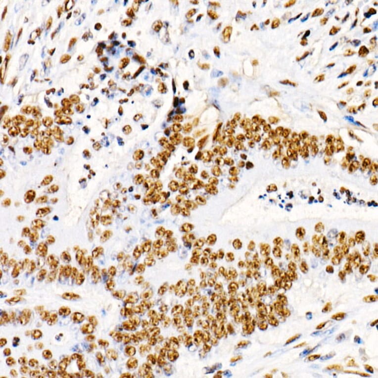 Immunohistochemistry - Anti-PTEN (phospho Ser380 + Thr382 + Thr383) Antibody (A309256) - Antibodies.com