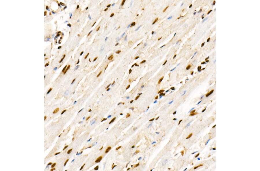 Immunohistochemistry - Anti-PTEN (phospho Ser380 + Thr382 + Thr383) Antibody (A309256) - Antibodies.com