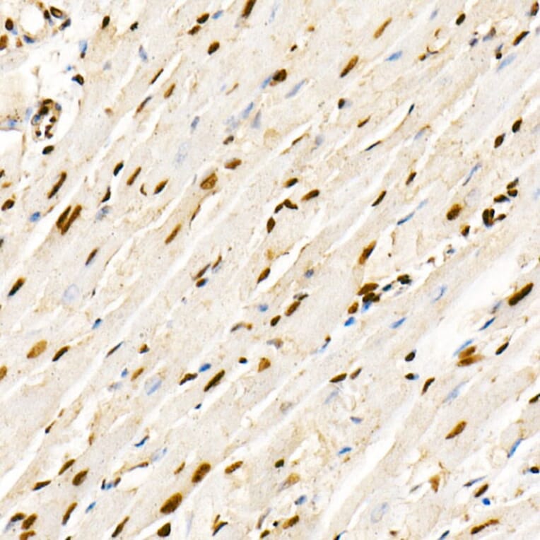Immunohistochemistry - Anti-PTEN (phospho Ser380 + Thr382 + Thr383) Antibody (A309256) - Antibodies.com