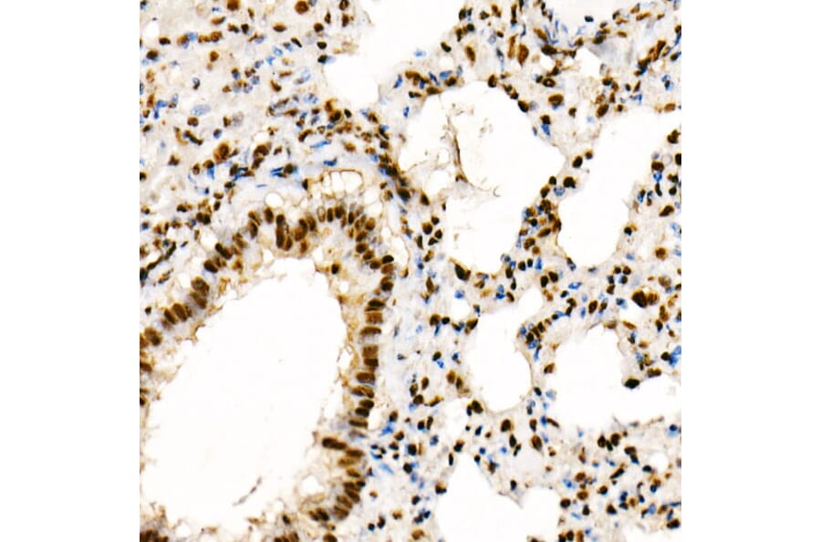 Immunohistochemistry - Anti-PTEN (phospho Ser380 + Thr382 + Thr383) Antibody (A309256) - Antibodies.com