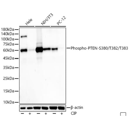Western Blot - Anti-PTEN (phospho Ser380 + Thr382 + Thr383) Antibody [ARC55940] (A309257) - Antibodies.com