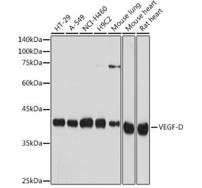 Western Blot - Anti-VEGFD Antibody [ARC2402] (A309258) - Antibodies.com