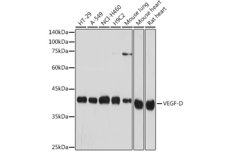 Western Blot - Anti-VEGFD Antibody [ARC2402] (A309258) - Antibodies.com