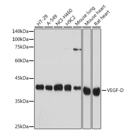 Western Blot - Anti-VEGFD Antibody [ARC2402] (A309258) - Antibodies.com