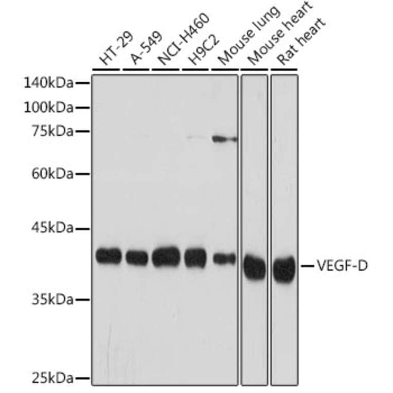 Western Blot - Anti-VEGFD Antibody [ARC2402] (A309258) - Antibodies.com