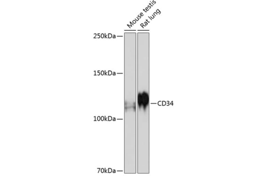 Western Blot - Anti-CD34 Antibody [ARC0219] (A309259) - Antibodies.com
